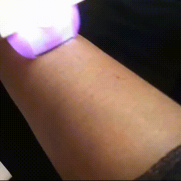 Elimina el vello en minutos, sin dolor y desde casa